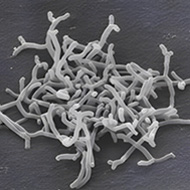 Bifidobacterium longum subsp. largoBL21